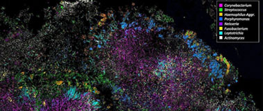 A color-coded view through the microscope shows part of the diverse bacterial population that flourishes inside the mouth.