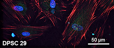 dental pulp stem cells (DPSCs)