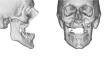 front and side scan of patient
