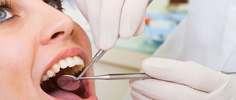 Women with mouth open for dental exam